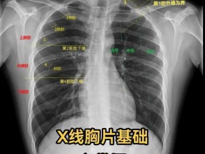 100%胸片曝光(100%胸片曝光这些秘密你必须知道)