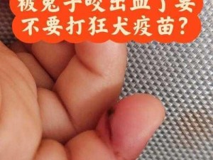 男朋友咬我的小兔子头会发炎吗_男朋友咬我的小兔子头，这种行为可能会导致发炎吗？