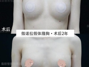 直播隆胸产品介绍：安全有效，快速隆胸，让你轻松拥有完美身材