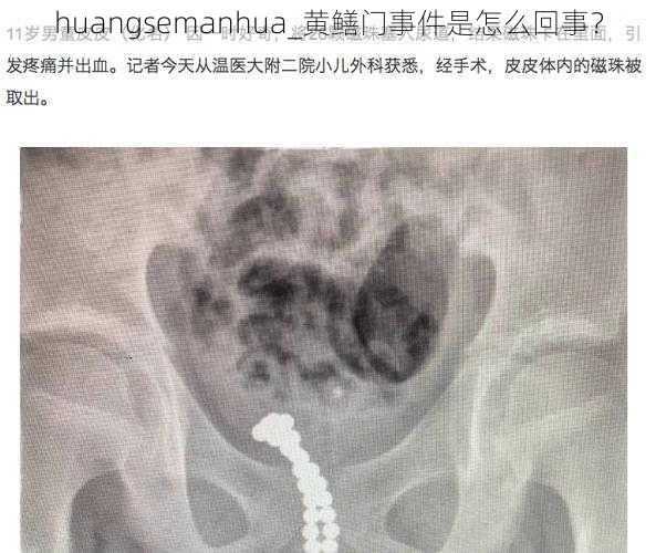 huangsemanhua_黄鳝门事件是怎么回事？