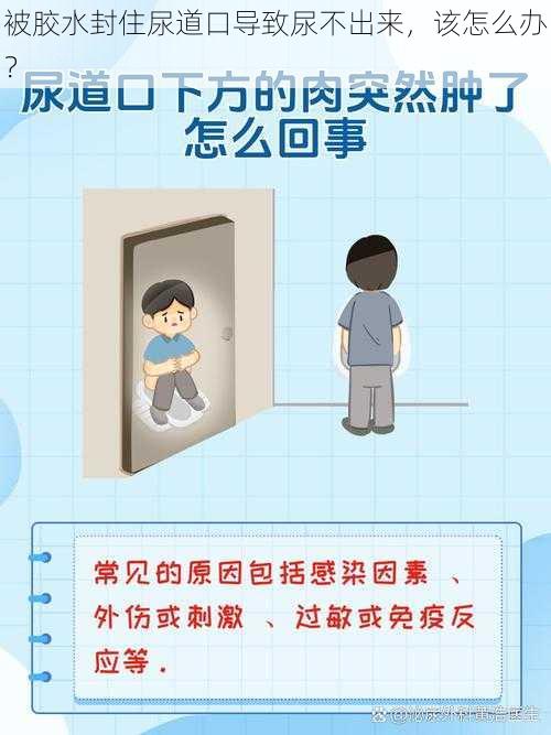 被胶水封住尿道口导致尿不出来，该怎么办？